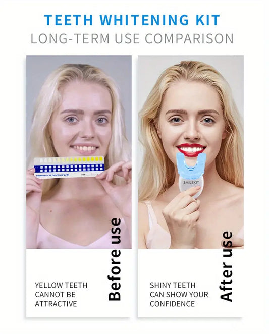Teeth Whitening Kit with LED Light and Gel (4pcs)